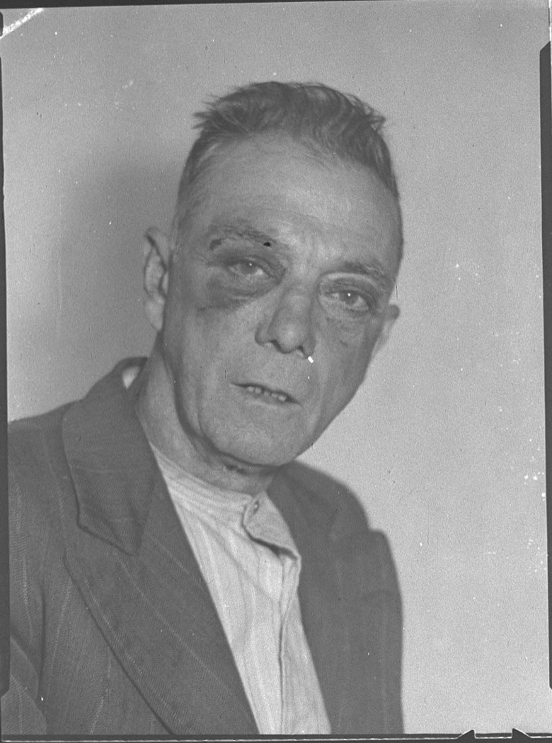 Black eye taken for Mr Finlay (1947)