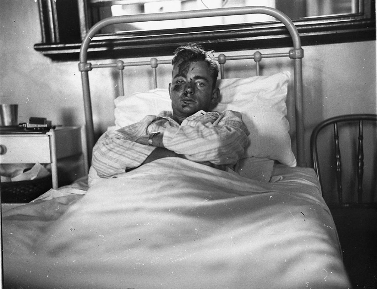 Speedway driver Harry Lewis recovers in St Vincents Hospital, Sydney (1935)